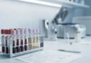 Provetta di sangue con referto che mostra creatinina alta valori accanto al calcolo dell'eGFR