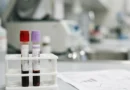 Provetta per l'esame del sangue che confronta PCR e VES, i due indici di infiammazione, in laboratorio di analisi