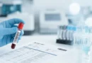 Provetta per le analisi del sangue accanto al referto di una gamma GT alta in un laboratorio ospedaliero